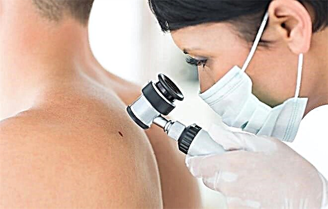 Prednosti liječenja raka kože u Izraelu